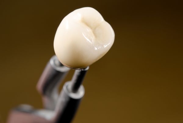 Chipped Tooth: Causes, Treatment, Recovery