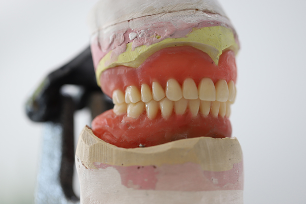 Examples Of Denture Repair