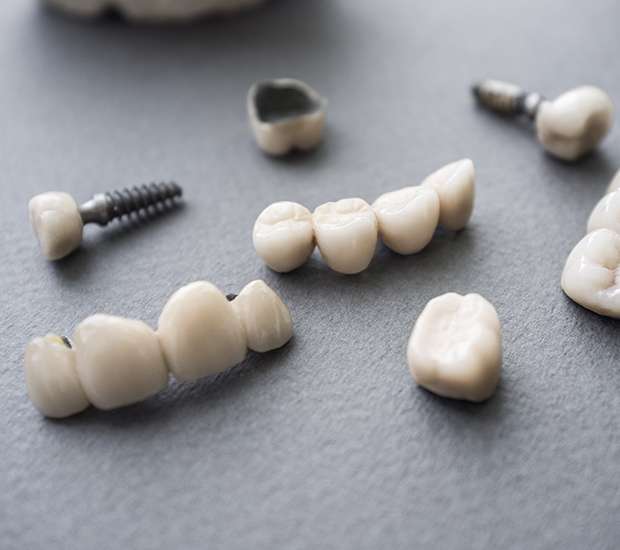 Port Charlotte The Difference Between Dental Implants and Mini Dental Implants