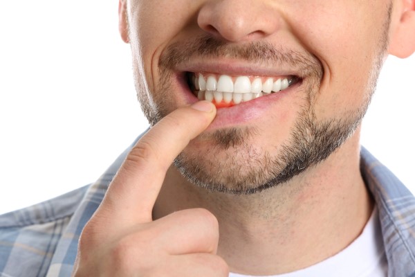 Can Periodontics Improve Your Oral Health?