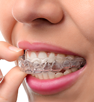 Clear Aligners - Almost Invisible Braces Port Charlotte, FL