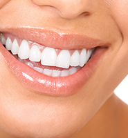 Teeth Whitening Services Port Charlotte, FL