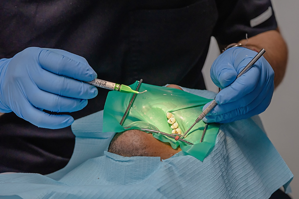 Replacing Lost Teeth: A Modern Dentist’s Decision Making Framework