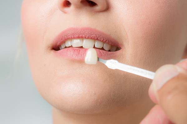 How Are Veneers Used In Cosmetic Dentistry?