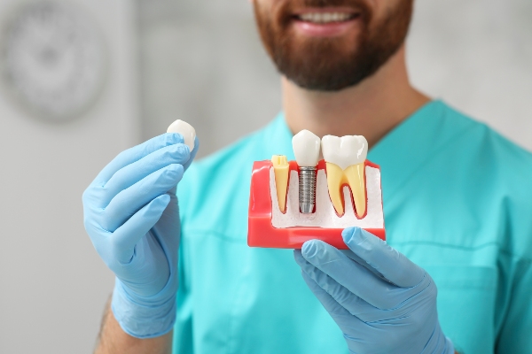 What Is An Implant Dentist And How Can They Help You?